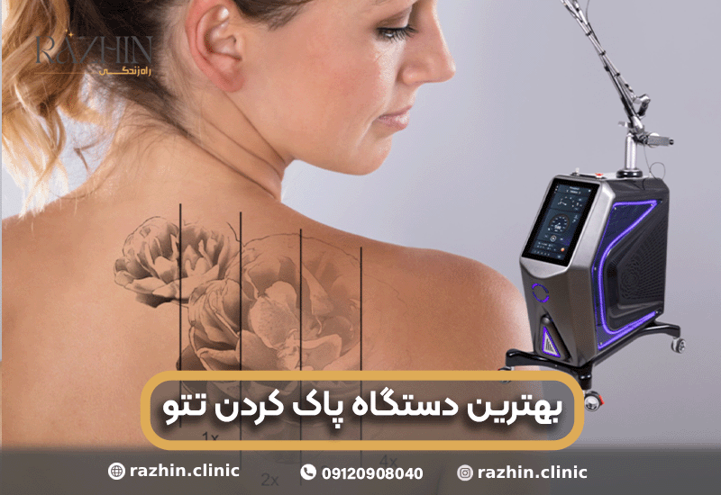 بهترین دستگاه پاک کردن تتو