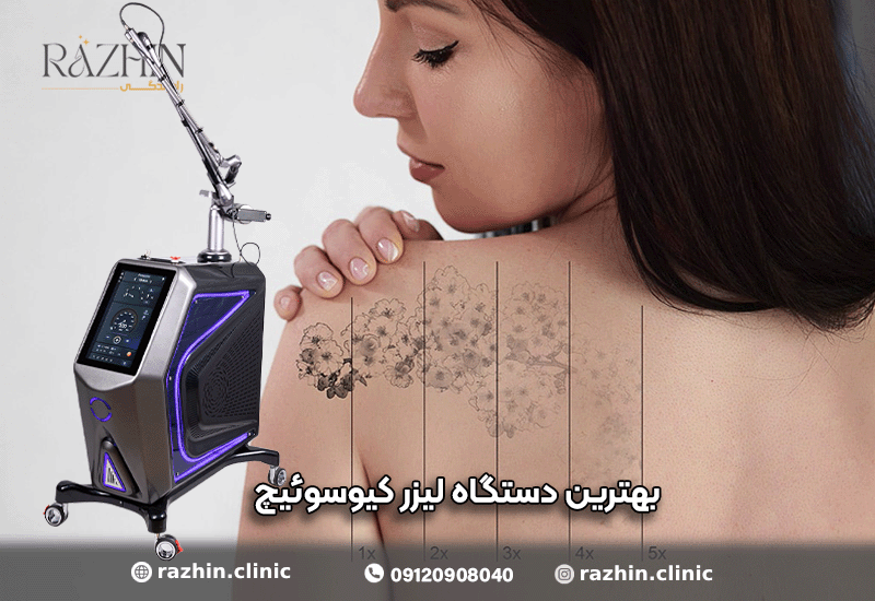 لیزر کیوسوئیچ