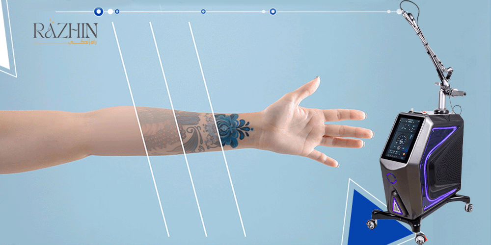 دستگاه لیزر کیوسوئیچ