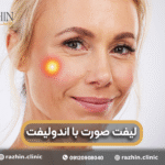 لیفت صورت با لیزر اندولیفت