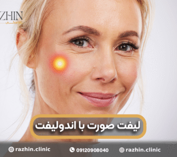 لیفت صورت با لیزر اندولیفت