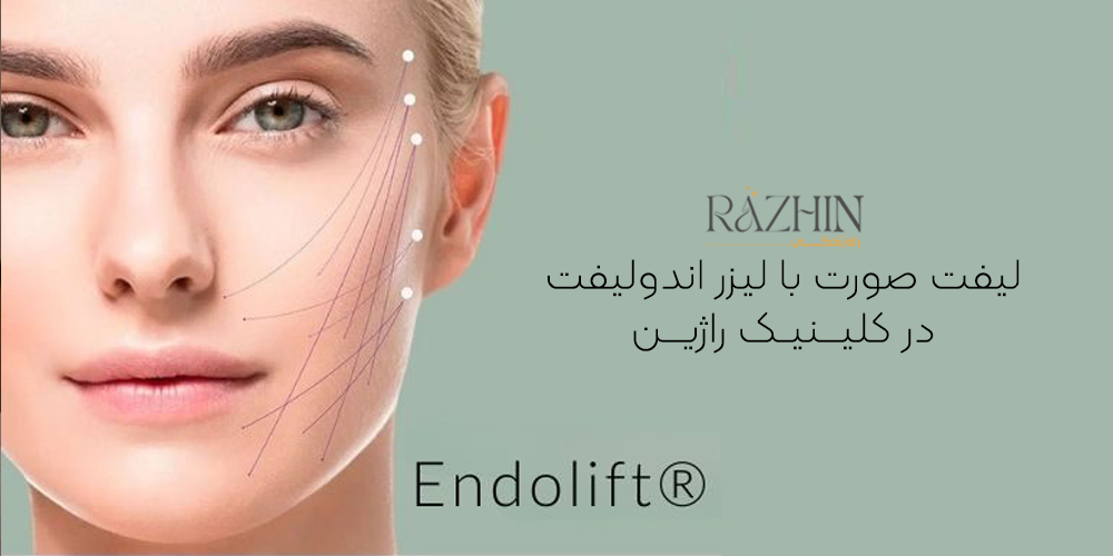 لیفت صورت با لیزر اندولیفت