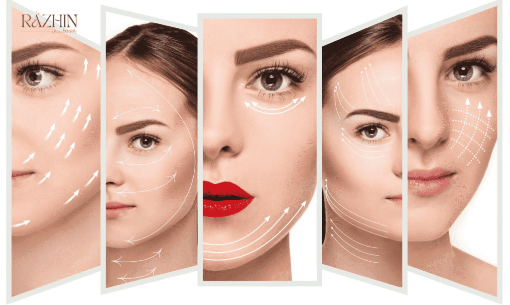 آموزش لیفت با نخ