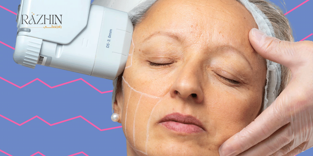 آموزش کار با دستگاه هایفو