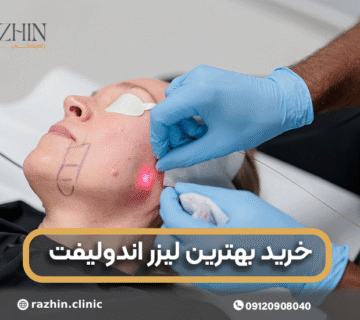 خرید بهترین لیزر اندولیفت