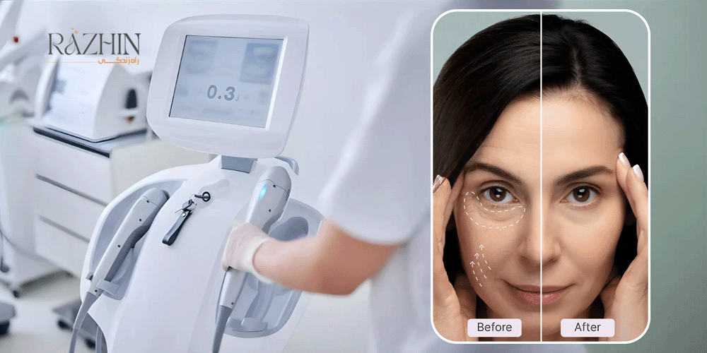 خرید هایفو دست دوم