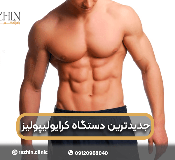 جدیدترین دستگاه کرایولیپولیز