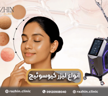 انواع لیزر کیوسوئیچ