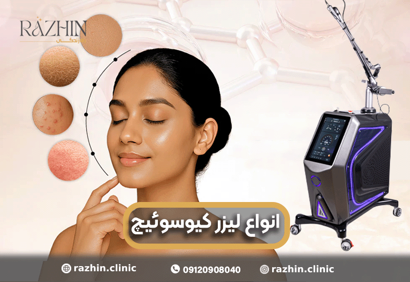 انواع لیزر کیوسوئیچ