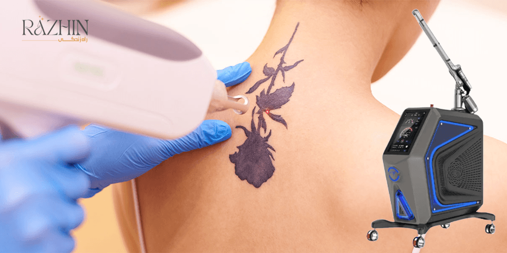 درمان لک با لیزر کیوسوئیچ