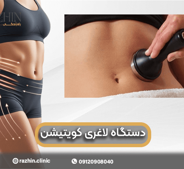 دستگاه لاغری کویتیشن