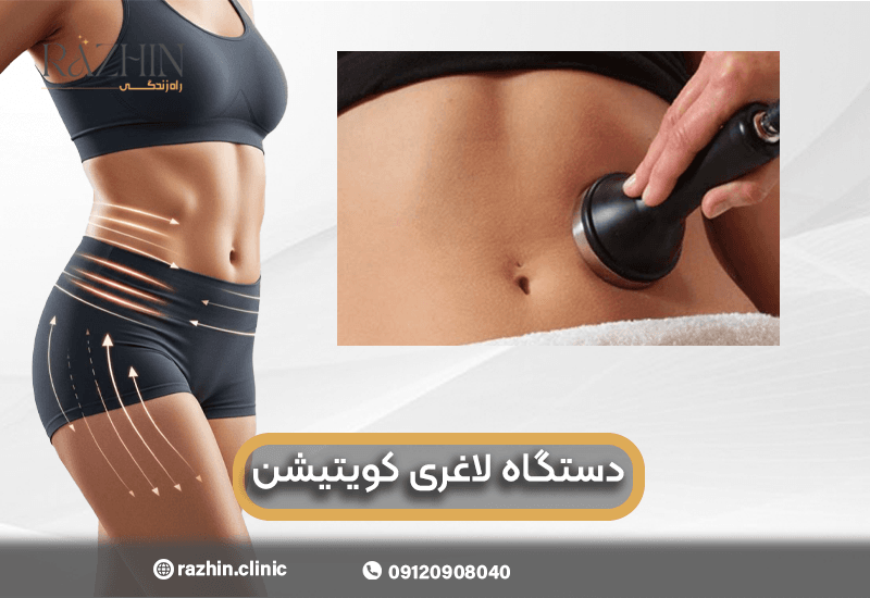 دستگاه لاغری کویتیشن