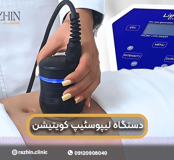 دستگاه لیپوسوئیپ کویتیشن