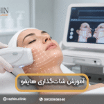 آموزش شات گذاری هایفو