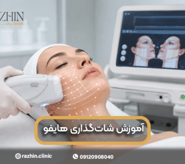 آموزش شات گذاری هایفو
