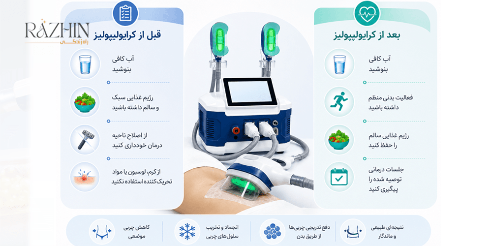 مراقبت های قبل و بعد از کرایو