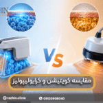 مقایسه کرایولیپولیز و کویتیشن