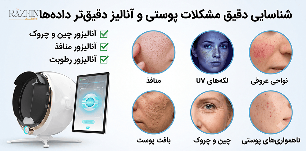 دستگاه آنالیز پوست بیت موجی