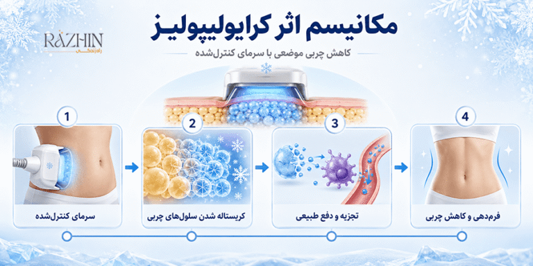 قیمت دستگاه کرایو 360