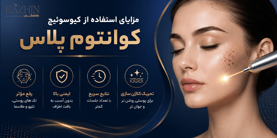 قیمت دستگاه کیوسوئیچ کوانتوم پلاس