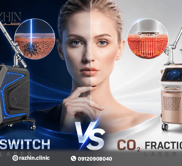 تفاوت لیزر کیوسوئیچ و لیزر CO۲ فرکشنال