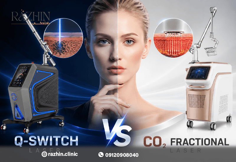 تفاوت لیزر کیوسوئیچ و لیزر CO۲ فرکشنال