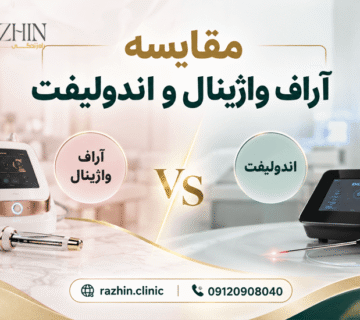 خرید دستگاه آر اف واژینال یا دستگاه اندولیفت