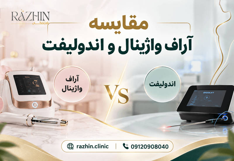 خرید دستگاه آر اف واژینال یا دستگاه اندولیفت