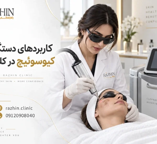کاربرد دستگاه کیوسوئیچ در کلینیک
