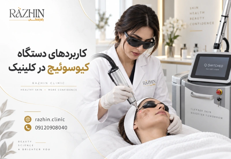 کاربرد دستگاه کیوسوئیچ در کلینیک