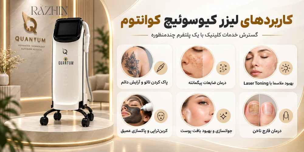 دستگاه کیوسوئیچ کوانتوم