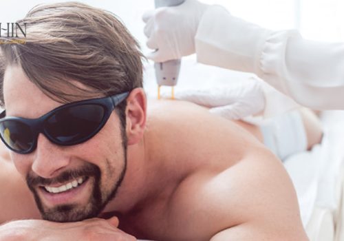 لیزر الکساندرایت راژین